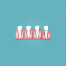 Infobild Zahnprobleme